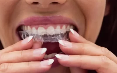 Invisalign San Bernardino: Clear Aligner Therapy for Discreet Orthodontic Correction